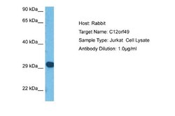 C12orf49 Antibody, Novus Biologicals 100 &mu;L | Buy Online | Novus Biologicals | Fisher Scientific
